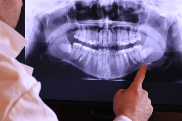 Best Emergency Tooth Extraction in Palisades Park, NJ
